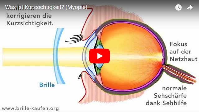 Brillen & Sehhilfen | Ratgeber Brille & Sehen pour Wie Ist Das Auge Aufgebaut
