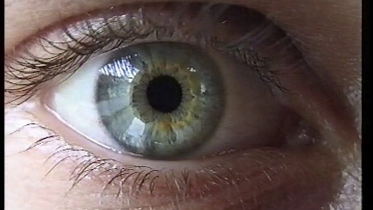 Das Auge – dedans Wie Ist Das Auge Aufgebaut