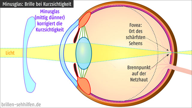 Dioptrie Bei Kurzsichtigkeit (- Dpt) à Wie Ist Das Auge Aufgebaut