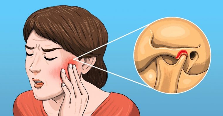 5 Douleurs Que Vous Pensez Être Un Mal De Dents Mais Qui pour Photo De Mal