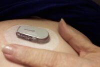 view dexcom 6 instruction manual images