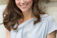 khris middleton hairline